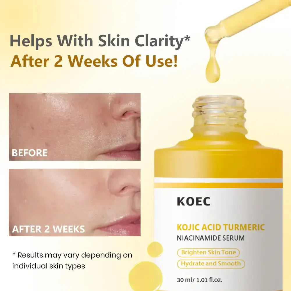 30ml Kojic Acid Turmeric Niacinamide Serum